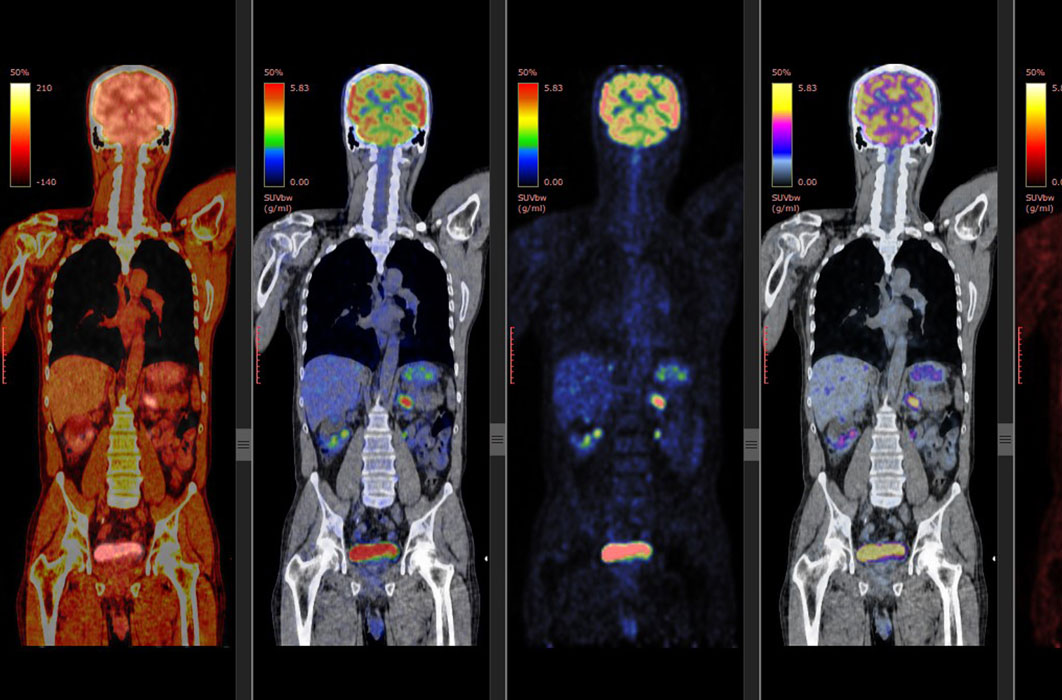 Nuclear Medicine Ajmer