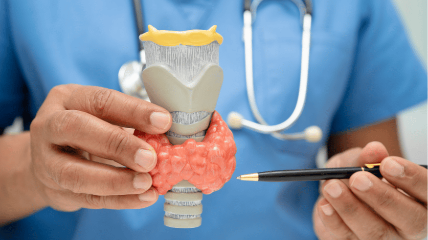 Thyroid Cancer