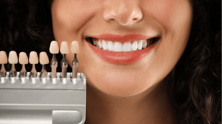 causes of yellow teeth