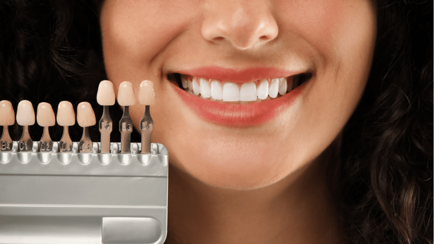causes of yellow teeth