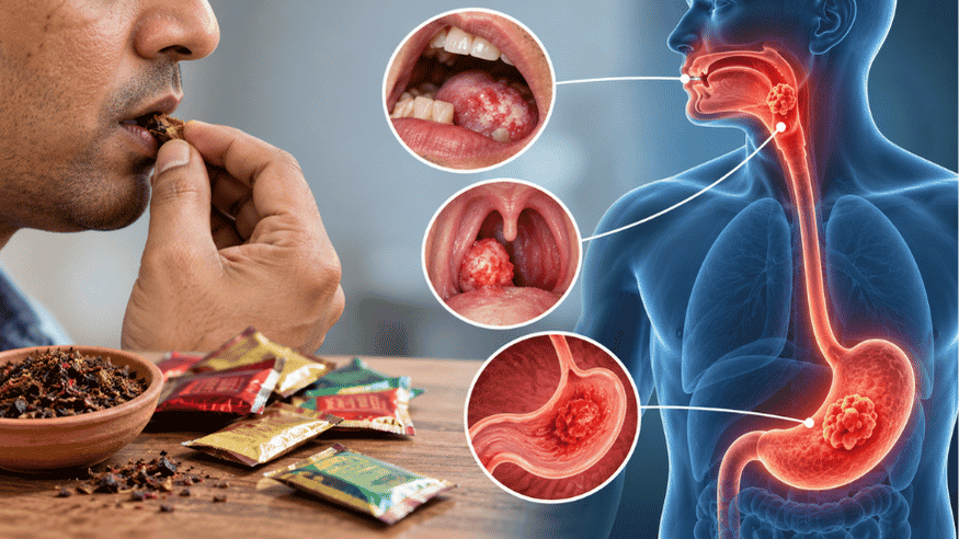 Tobacco, Gutkha and Cancer